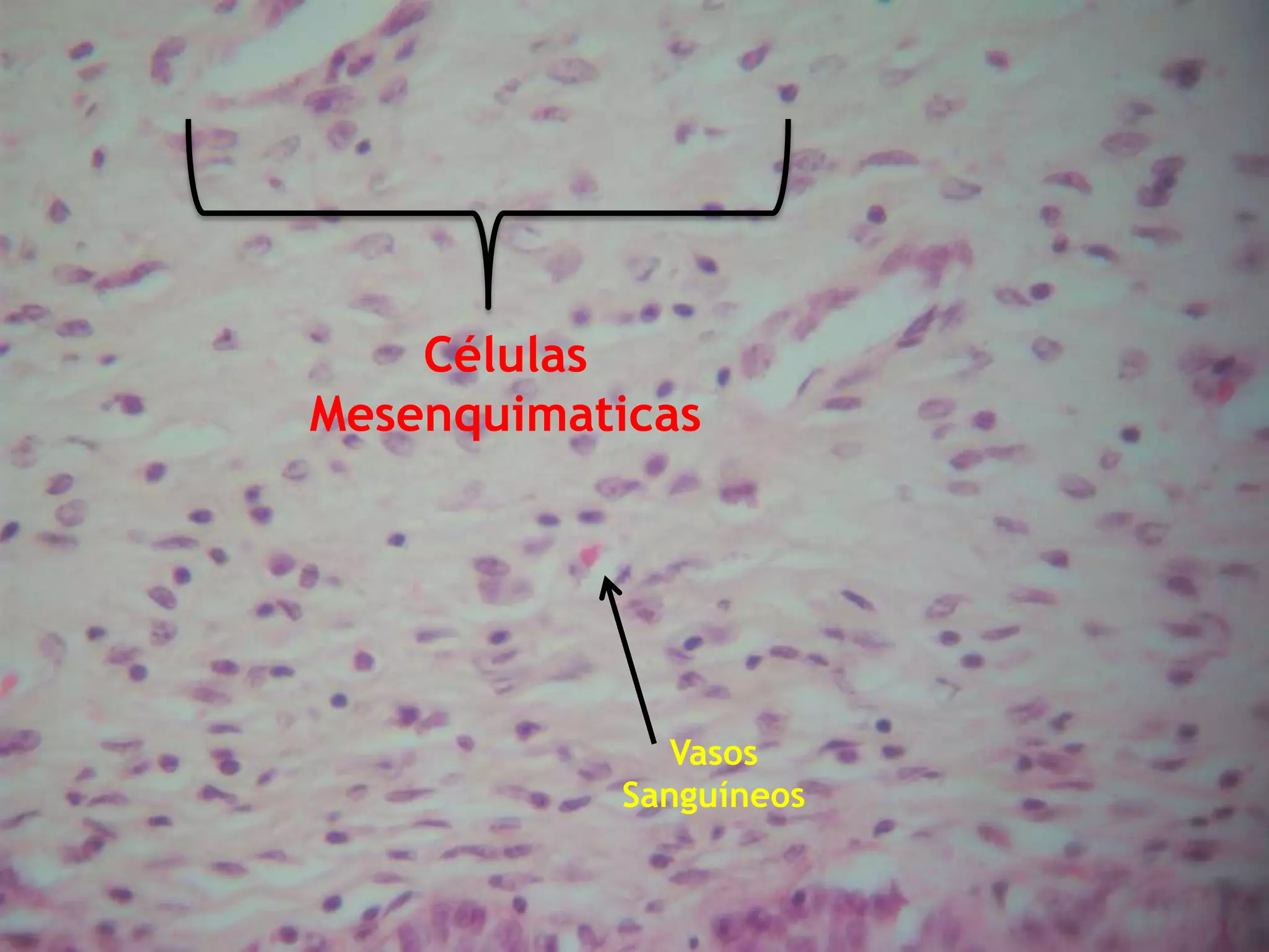 Células Mesenquimaticas Vasos Sanguíneos