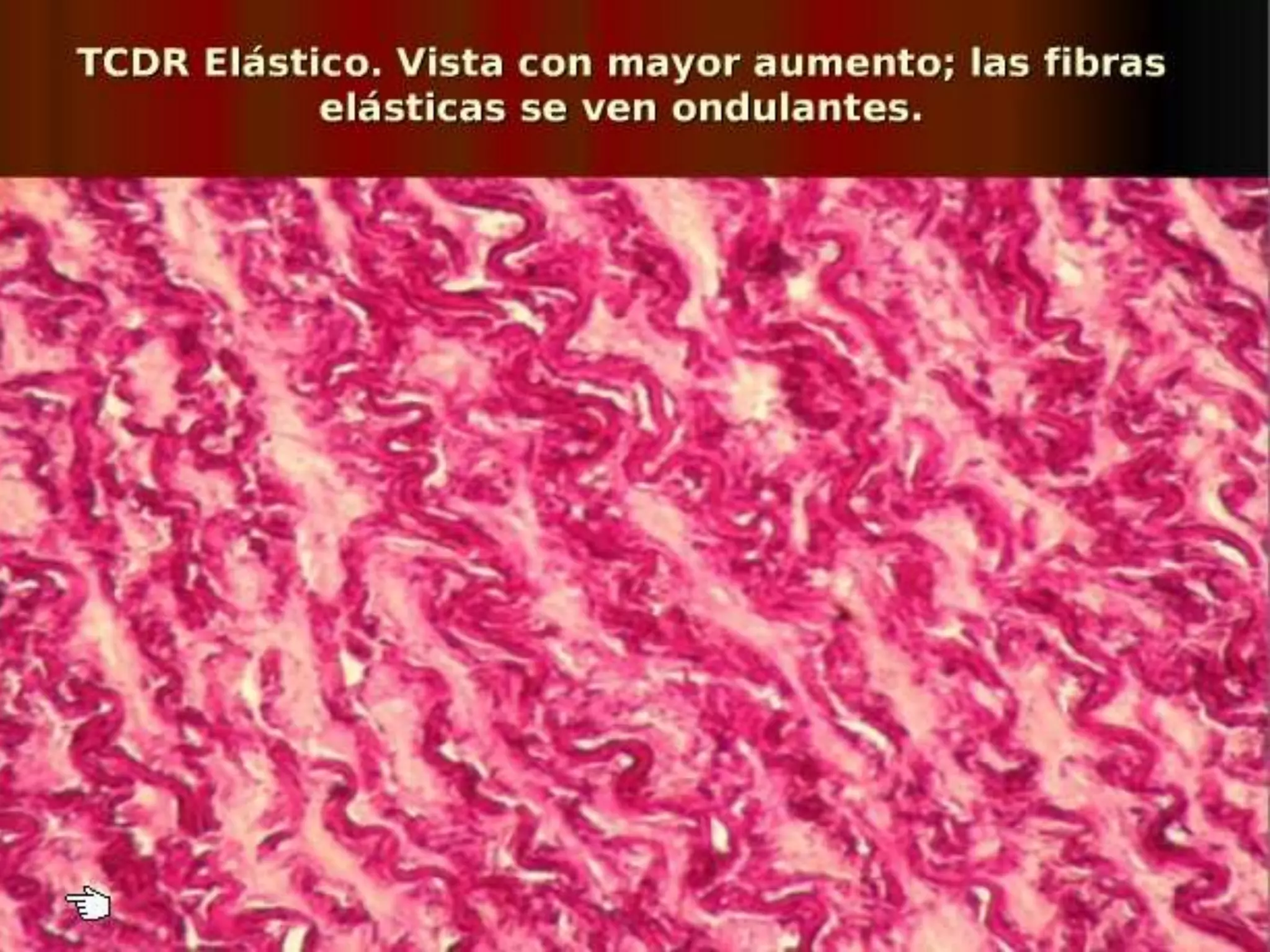 Tejido conjuntivo conectivo