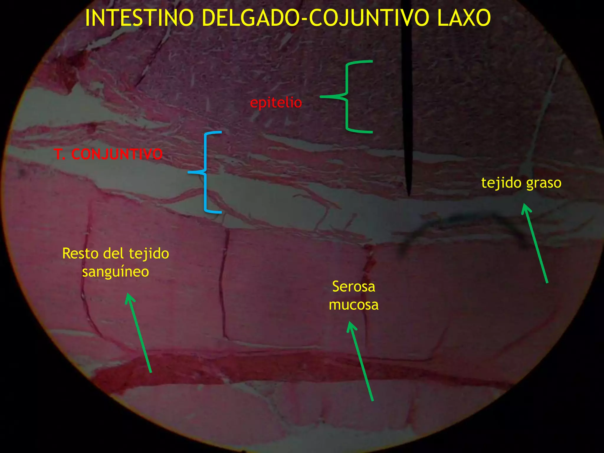 INTESTINO DELGADO-COJUNTIVO LAXOepitelio T. CONJUNTIVO tejido grasoResto del tejido sanguíneoSerosa mucosa