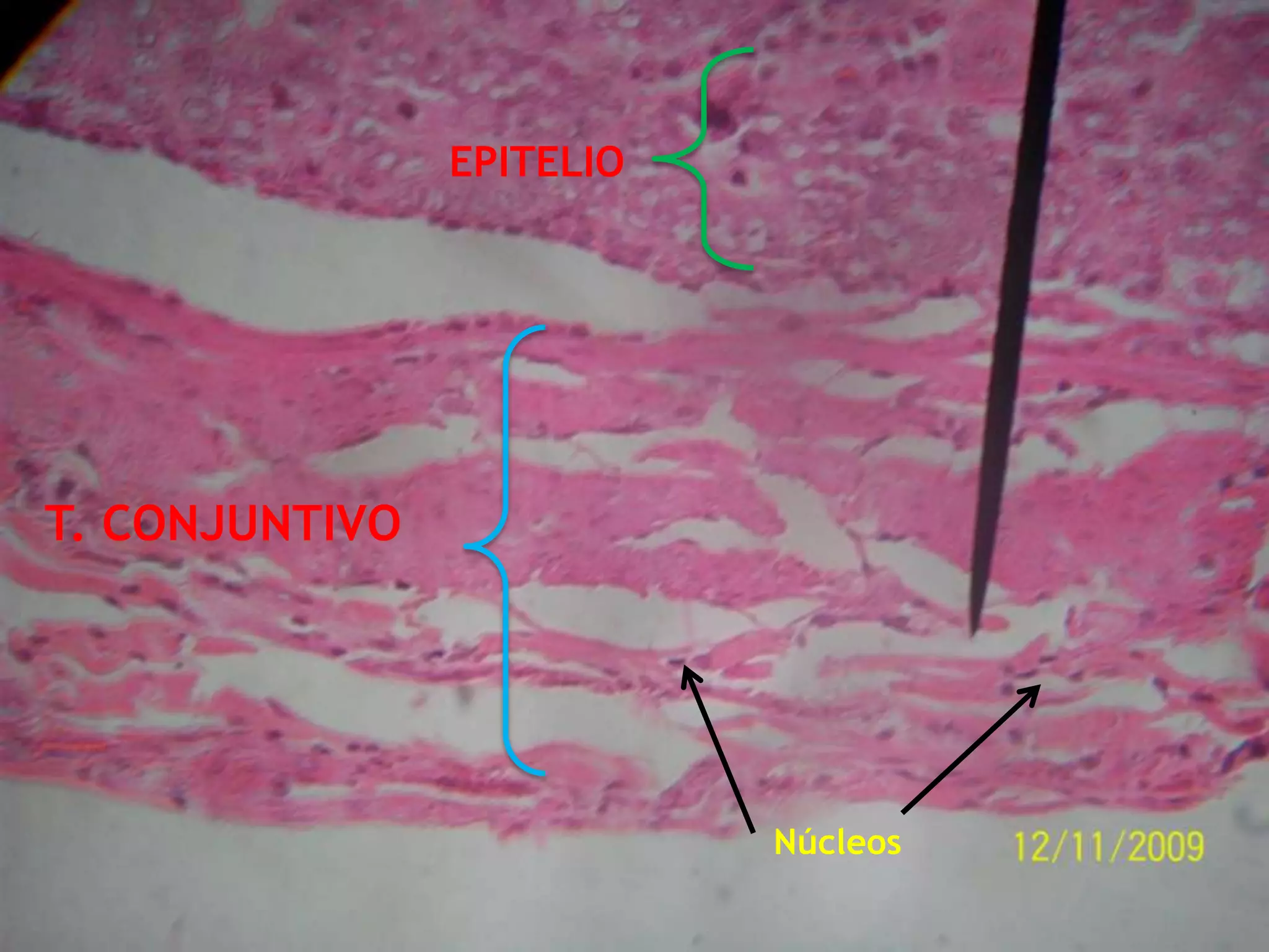 EPITELIOT. CONJUNTIVONúcleos