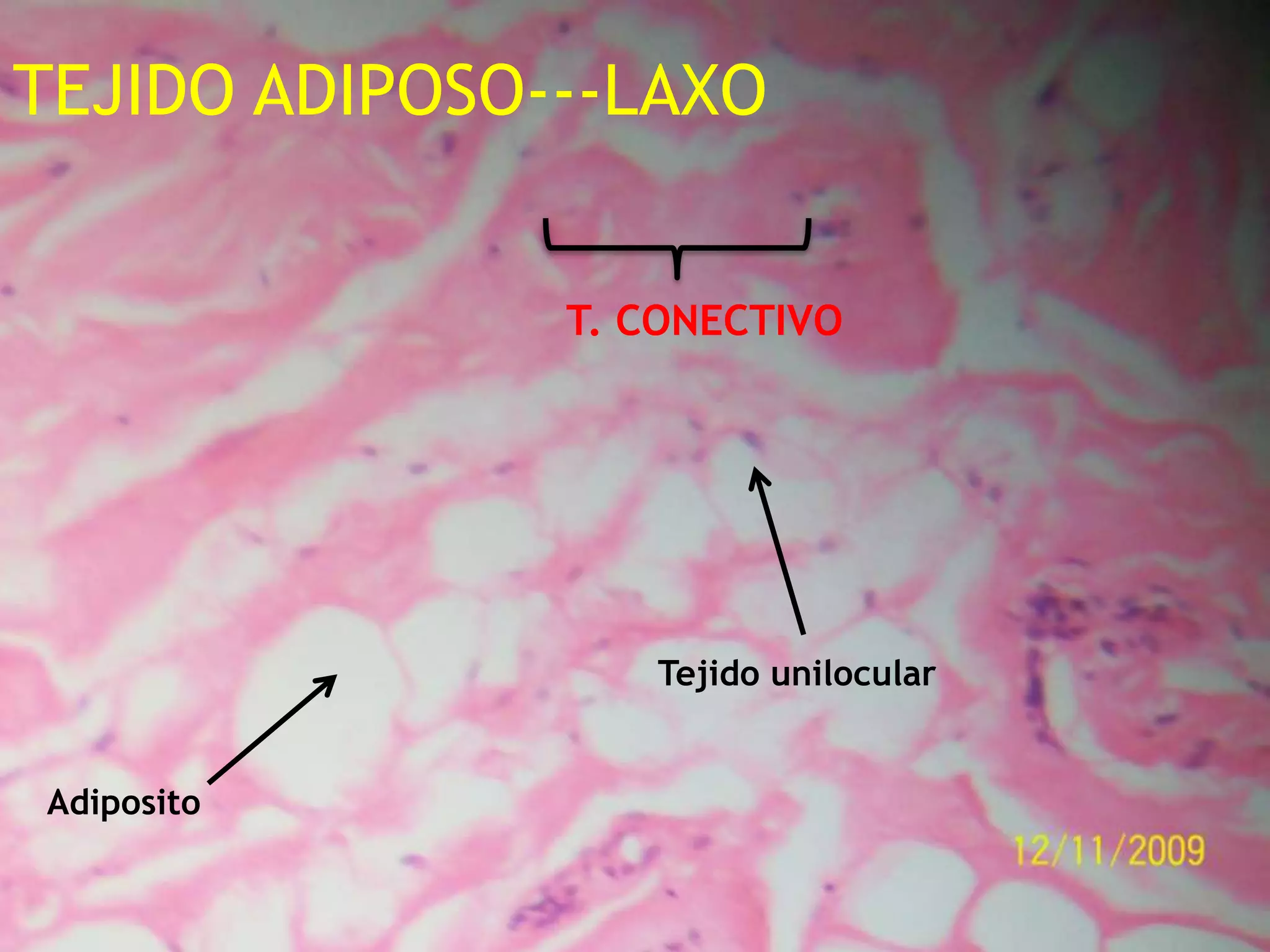 TEJIDO ADIPOSO---LAXO T. CONECTIVOTejido unilocularAdiposito