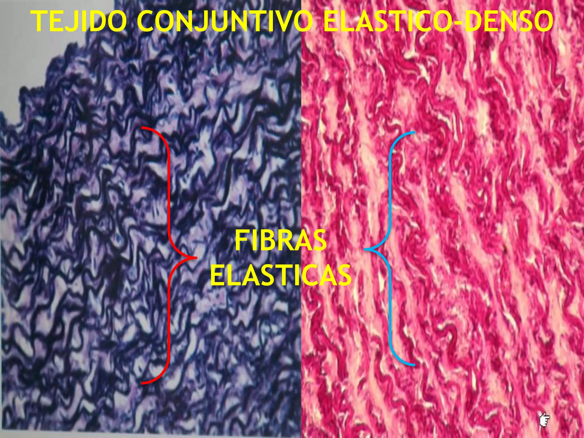 TEJIDO CONJUNTIVO ELASTICO-DENSOFIBRAS ELASTICAS