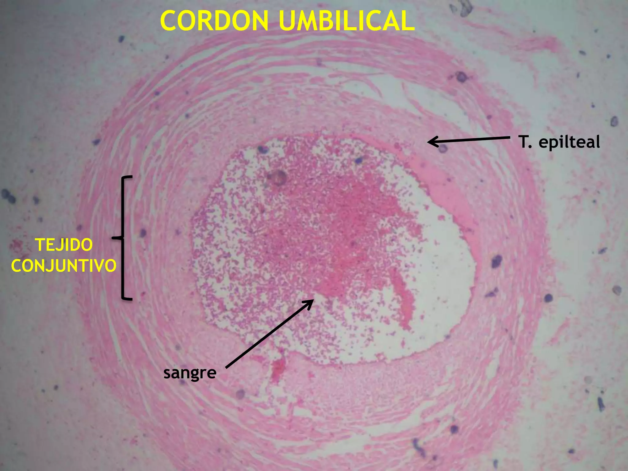 CORDON UMBILICAL T. epiltealTEJIDO CONJUNTIVOsangre
