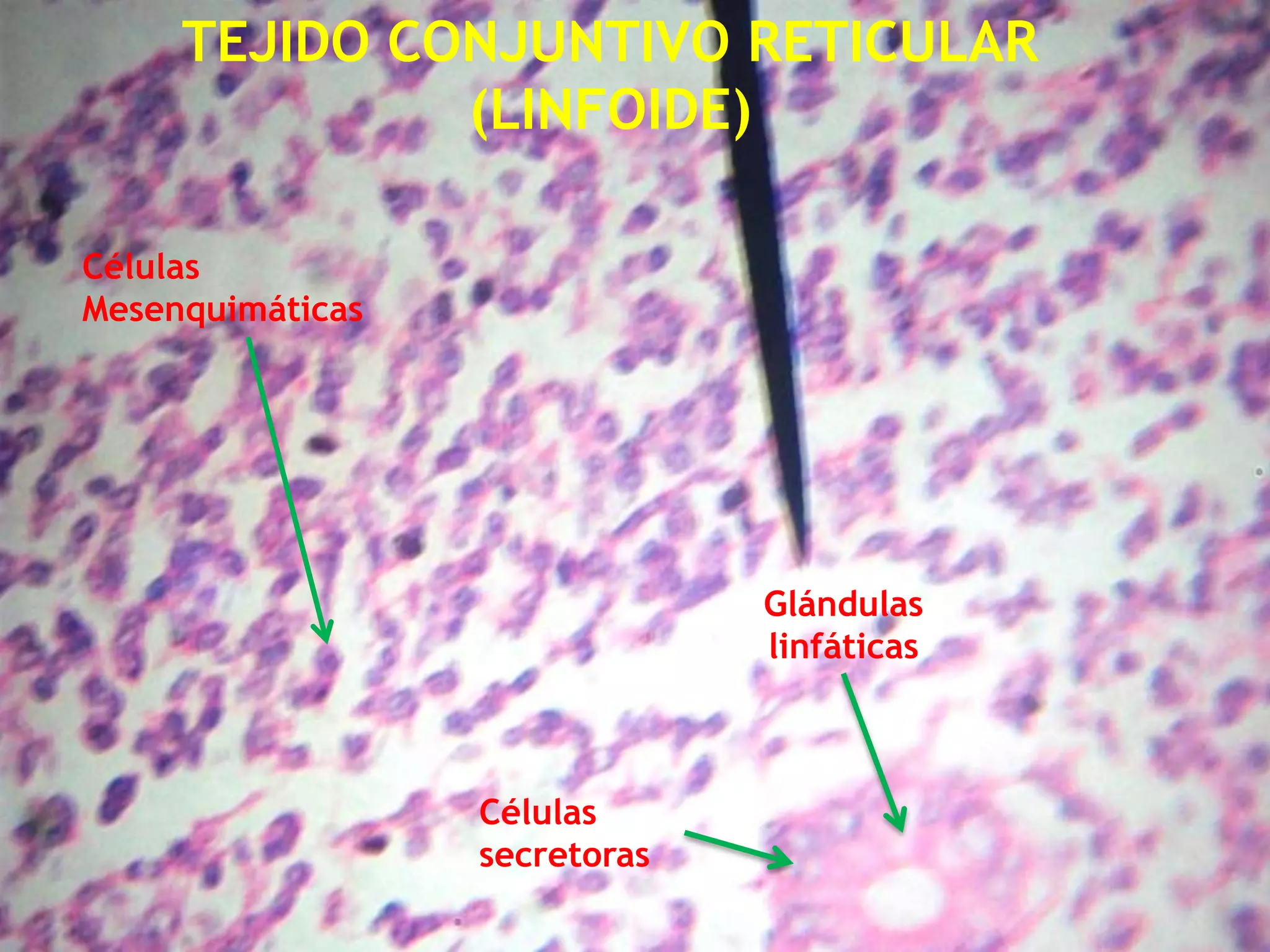 TEJIDO CONJUNTIVO RETICULAR (LINFOIDE)Células MesenquimáticasGlándulas linfáticasCélulas secretoras