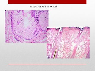 GLANDULAS SEBACEAS