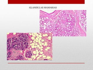 GLANDULAS MAMARIAS