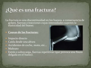 La fractura es una discontinuidad en los huesos, a consecuencia de 
golpes, fuerzas o tracciones cuyas intensidades superen la 
elasticidad del hueso. 
 Causas de las fracturas: 
 Impacto directo 
 Caída desde una altura 
 Accidentes de coche, moto, etc… 
 Maltrato 
 Estrés o sobrecarga, fuerzas repetitivas (que provoca una fisura 
delgada en el hueso). 
 