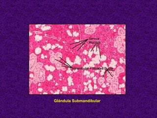 Glándula Submandibular 