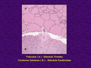 Folículos ( A ) : Glándula Tiroides Cordones Celulares ( B ) :  Glándula Paratiroides A B 