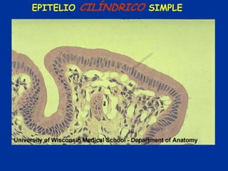 EPITELIO   CILÍNDRICO SIMPLE
 