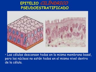 EPITELIO CILÍNDRICO
          PSEUDOESTRATIFICADO




• Las células descansan todas en la misma membrana basal,
pero los núcleos no están todos en el mismo nivel dentro
de la célula.
 