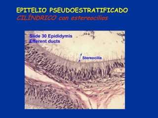 EPITELIO PSEUDOESTRATIFICADO
CILÍNDRICO con estereocilios
 