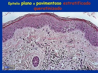Epitelio   plano   opavimentoso estratificado
                   queratinizado
 