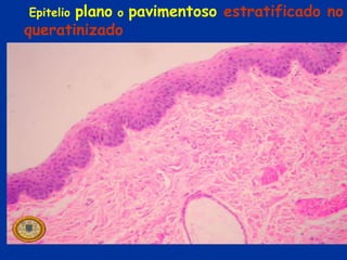 plano o pavimentoso estratificado no
Epitelio
queratinizado
 