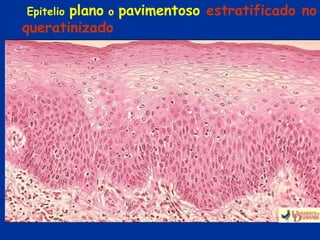 plano o pavimentoso estratificado no
Epitelio
queratinizado
 