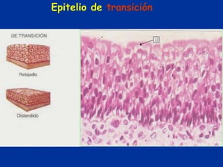 Epitelio de transición
 