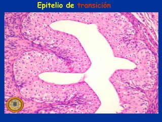 Epitelio de transición
 