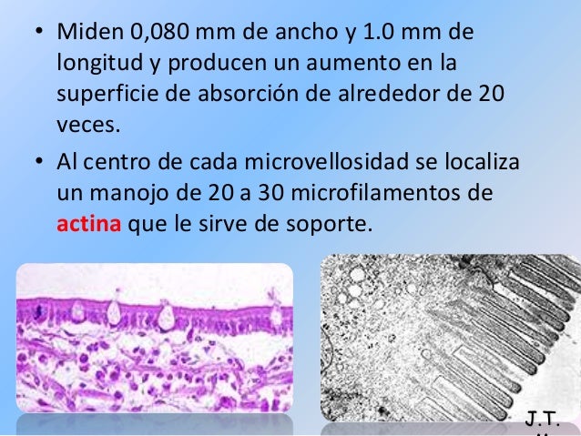 La tobera para el aumento del espesor el miembro