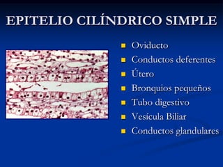 EPITELIO CILÍNDRICO SIMPLE








Oviducto
Conductos deferentes
Útero
Bronquios pequeños
Tubo digestivo
Vesícula Biliar
Conductos glandulares

 