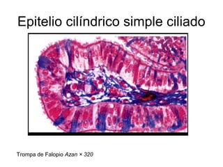 Epitelio cilíndrico simple ciliado

Trompa de Falopio Azan × 320

 