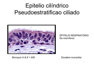 Epitelio cilíndrico
Pseudoestratificao ciliado

EPITELIO RESPIRATORIO
De mamíferos

Bronquio H & E × 600

Escalera mucociliar

 