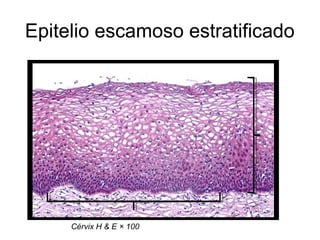 Epitelio escamoso estratificado

Cérvix H & E × 100

 