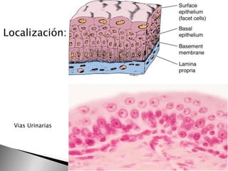 Localización:

Vias Urinarias

 