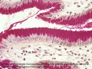 Epitelio cilíndrico simple mucosecretor de la mucosa gástrica, se observa la mucina en
color magenta, histoquímica PAS y van Gieson.

 