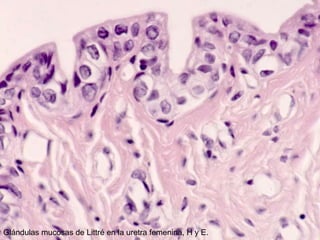 Glándulas mucosas de Littré en la uretra femenina, H y E.

 