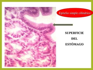 Epitelio simple cilíndricoEpitelio simple cilíndrico
SUPERFICIESUPERFICIE
DELDEL
ESTÓMAGOESTÓMAGO
 