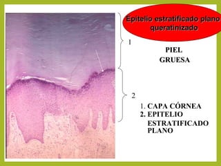 Epitelio estratificado planoEpitelio estratificado plano
queratinizadoqueratinizado
PIELPIEL
GRUESAGRUESA
1
2
1. CAPA CÓRNEA
2. EPITELIO
ESTRATIFICADO
PLANO
 