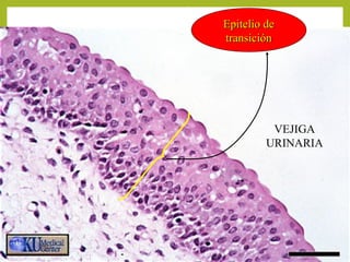 Epitelio deEpitelio de
transicióntransición
VEJIGA
URINARIA
 
