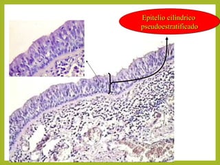 Epitelio cilíndricoEpitelio cilíndrico
pseudoestratificadopseudoestratificado
 