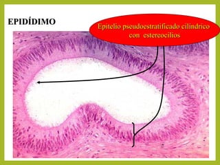 Epitelio pseudoestratificado cilíndricoEpitelio pseudoestratificado cilíndrico
con estereocilioscon estereocilios
EPIDÍDIMOEPIDÍDIMO
 