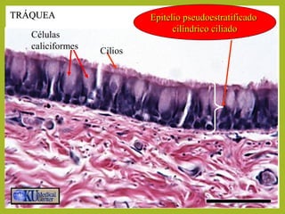Epitelio pseudoestratificadoEpitelio pseudoestratificado
cilíndrico ciliadocilíndrico ciliado
TRÁQUEATRÁQUEA
Cilios
Células
caliciformes
 