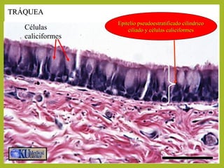 Epitelio pseudoestratificado cilíndricoEpitelio pseudoestratificado cilíndrico
ciliado y células caliciformesciliado y células caliciformes
TRÁQUEATRÁQUEA
Células
caliciformes
 