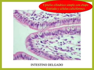 Epitelio cilíndrico simple con chapaEpitelio cilíndrico simple con chapa
Estriada y células caliciformesEstriada y células caliciformes
INTESTINO DELGADOINTESTINO DELGADO
 