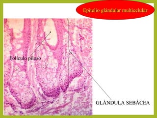 GLÁNDULA SEBÁCEAGLÁNDULA SEBÁCEA
Epitelio glándular multicelularEpitelio glándular multicelular
Folículo piloso
 
