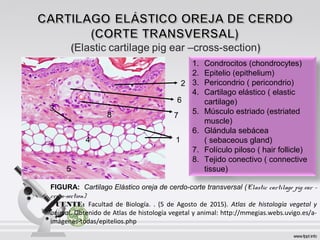 1
2
3
4
7
5
6
8
1. Condrocitos (chondrocytes)
2. Epitelio (epithelium)
3. Pericondrio ( pericondrio)
4. Cartilago elástico ( elastic
cartilage)
5. Músculo estriado (estriated
muscle)
6. Glándula sebácea
( sebaceous gland)
7. Folículo piloso ( hair follicle)
8. Tejido conectivo ( connective
tissue)
FIGURA: Cartilago Elástico oreja de cerdo-corte transversal (Elastic cartilage pig ear –
cross-section)
FUENTE: Facultad de Biología. . (5 de Agosto de 2015). Atlas de histología vegetal y
animal. Obtenido de Atlas de histología vegetal y animal: http://mmegias.webs.uvigo.es/a-
imágenes-todas/epitelios.php
 