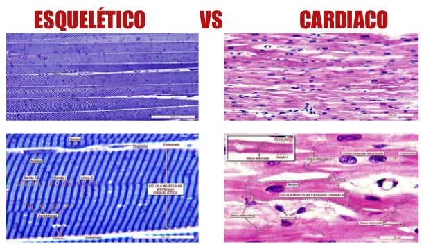 Diferencia Entre Musculo Esqueletico Y Cardiaco