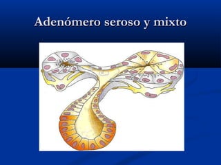 Adenómero seroso y mixtoAdenómero seroso y mixto
 