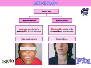 SECRECIÓN 
Hipersecreción 
Secreción 
Hiposecreción 
Aumento excesivo de la 
producción de una hormona. 
Disminución notable en la 
producción de una hormona. 
Hiperparatiroidismo Hipotiroidismo 
 