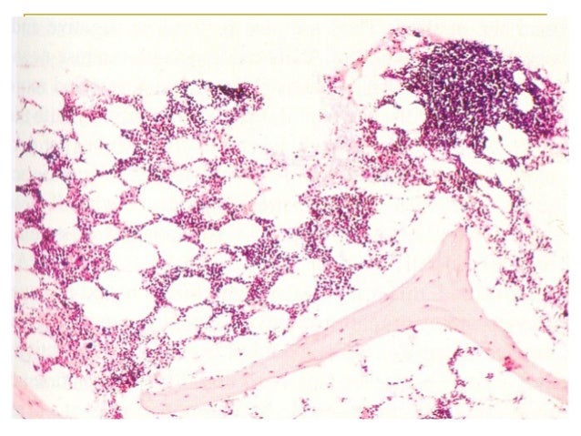 Tejido hematopoyetico