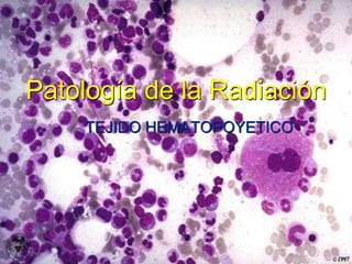 Patología de la Radiación
TEJIDO HEMATOPOYETICO
 