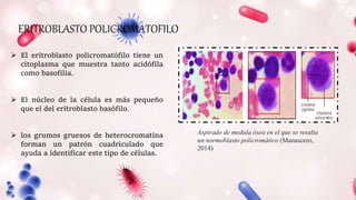 Aspirado de medula ósea en el que se resalta
un normoblasto policromático (Manascero,
2014)
ERITROBLASTO POLICROMATOFILO
 El eritroblasto policromatófilo tiene un
citoplasma que muestra tanto acidófila
como basofilia.
 El núcleo de la célula es más pequeño
que el del eritroblasto basófilo.
 los grumos gruesos de heterocromatina
forman un patrón cuadriculado que
ayuda a identificar este tipo de células.
 