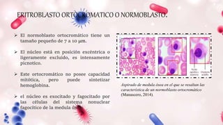 ERITROBLASTO ORTOCROMATICO O NORMOBLASTO.
Aspirado de medula ósea en el que se resaltan las
característica de un normoblasto ortocromático
(Manascero, 2014).
 El normoblasto ortocromático tiene un
tamaño pequeño de 7 a 10 μm.
 El núcleo está en posición excéntrica o
ligeramente excluido, es intensamente
picnotico.
 Este ortocromático no posee capacidad
mitótica, pero puede sintetizar
hemoglobina.
 el núcleo es exocitado y fagocitado por
las células del sistema nonuclear
fagocítico de la medula ósea.
 