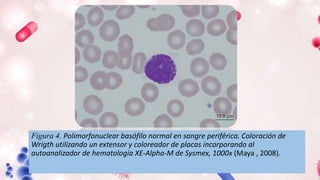 Figura 4. Polimorfonuclear basófilo normal en sangre periférica. Coloración de
Wrigth utilizando un extensor y coloreador de placas incorporando al
autoanalizador de hematología XE-Alpha-M de Sysmex, 1000x (Maya , 2008).
 