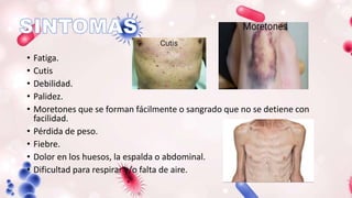 • Fatiga.
• Cutis
• Debilidad.
• Palidez.
• Moretones que se forman fácilmente o sangrado que no se detiene con
facilidad.
• Pérdida de peso.
• Fiebre.
• Dolor en los huesos, la espalda o abdominal.
• Dificultad para respirar y/o falta de aire.
 