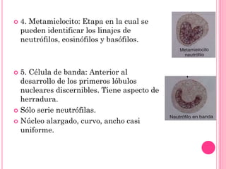  4. Metamielocito: Etapa en la cual se
pueden identificar los linajes de
neutrófilos, eosinófilos y basófilos.
 5. Célula de banda: Anterior al
desarrollo de los primeros lóbulos
nucleares discernibles. Tiene aspecto de
herradura.
 Sólo serie neutrófilas.
 Núcleo alargado, curvo, ancho casi
uniforme.
 