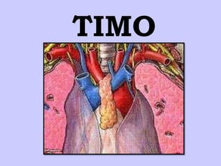 TIMO
 